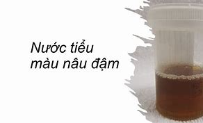 Trong Nước Tiểu Có Máu